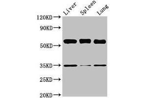 Western Blot Positive WB detected in: Mouse liver tissue, Mouse spleen tissue, Mouse lung tissue All lanes: Gba antibody at 3. (GBA 抗体  (AA 20-515))