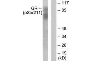 Western blot analysis of extracts from HeLa cells treated with Heat shock, using GR (Phospho-Ser211) Antibody. (GR (AA 181-230), (pSer211) 抗体)