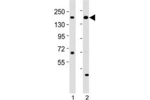 Western blot testing of Kdm6a antibody at 1:2000 dilution. (KDM6A 抗体  (C-Term))