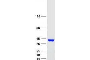 Western Blotting (WB) image for Annexin A2 (ANXA2) (Transcript Variant 1) protein (Myc-DYKDDDDK Tag) (ABIN2714738)