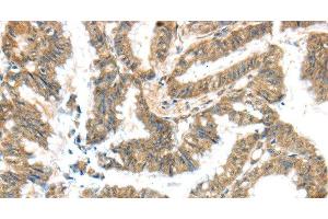 Immunohistochemistry (Paraffin-embedded Sections) (IHC (p)) image for anti-Potassium Voltage-Gated Channel, Subfamily G, Member 3 (KCNG3) antibody (ABIN7243487)