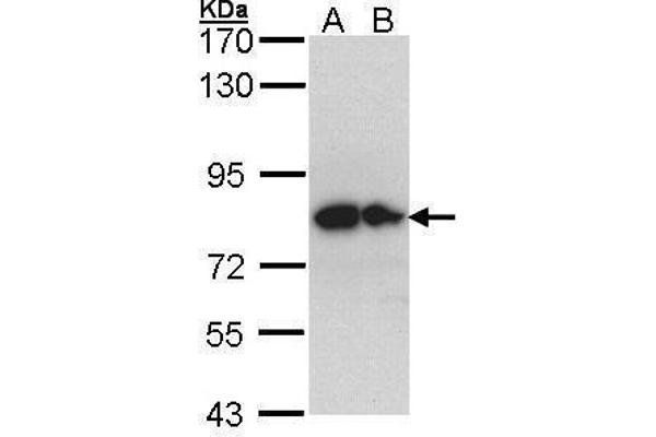 GPC1 抗体