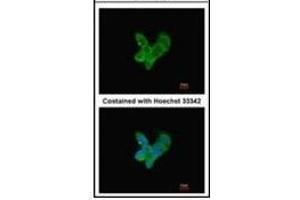 Immunofluorescence analysis of methanol-fixed HepG2, using Complement C9 antibody at 1/200 dilution. (C9 抗体)