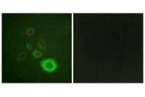 Immunofluorescence analysis of A549 cells, using c-Met (Ab-1003) antibody. (c-MET 抗体  (Tyr1003))