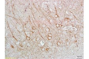 Immunohistochemistry (Paraffin-embedded Sections) (IHC (p)) image for anti-Nitric Oxide Synthase 1, Neuronal (NOS1) (AA 51-150) antibody (ABIN725585) (NOS1 抗体  (AA 51-150))