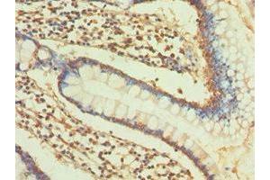 Immunohistochemistry (IHC) image for anti-Collagen, Type II, alpha 1 (COL2A1) (AA 1228-1487) antibody (ABIN7148198)