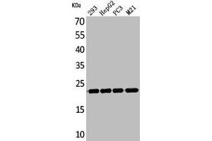 Western Blot analysis of 293 HepG2 PC-3 M21 cells using FGF-6 Polyclonal Antibody (FGF6 抗体  (C-Term))