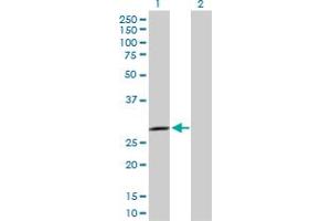 Western Blotting (WB) image for anti-SplA/ryanodine Receptor Domain and SOCS Box Containing 2 (SPSB2) (AA 1-263) antibody (ABIN529768)