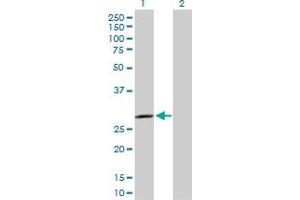 Western Blot analysis of SPSB2 expression in transfected 293T cell line by SPSB2 MaxPab polyclonal antibody. (SPSB2 抗体  (AA 1-263))