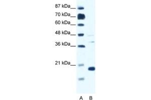 Western Blotting (WB) image for anti-Calcium Channel, Voltage-Dependent, gamma Subunit 1 (CACNG1) antibody (ABIN2461569) (CACNG1 抗体)