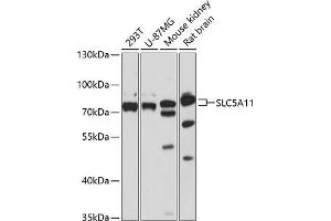 Western blot analysis of extracts of various cell lines, using SLC5 antibody (ABIN6127283, ABIN6148021, ABIN6148022 and ABIN6217058) at 1:3000 dilution. (Solute Carrier Family 5 (Sodium/inositol Cotransporter), Member 11 (SLC5A11) (AA 540-640) 抗体)