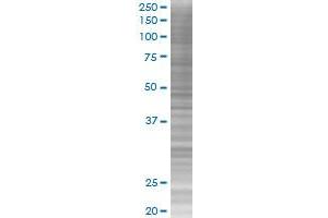Western Blotting (WB) image for ARNT 293T Cell Transient Overexpression Lysate(Denatured) (ABIN1330976)