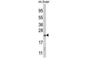 Western blot analysis of NQO2 Antibody (Center) in mouse liver tissue lysates (35ug/lane). (NQO2 抗体  (Middle Region))
