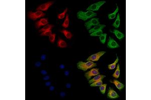 ABIN6263049 and ABIN6273132 staining Hela cells by IF/ICC.