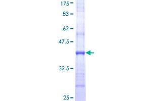 SLC15A1 Protein (AA 473-572) (GST tag)