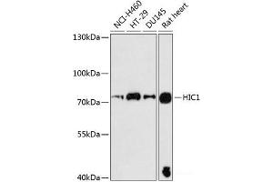 Western blot analysis of extracts of various cell lines using HIC1 Polyclonal Antibody at dilution of 1:3000. (HIC1 抗体)