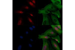 ABIN6257271 and ABIN6274269 staining  cells by IF/ICC.