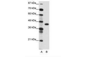 Image no. 1 for anti-Zinc Finger Protein 396 (ZNF396) (AA 181-230) antibody (ABIN6736117) (ZNF396 抗体  (AA 181-230))