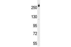 CAD antibody western blot analysis in Jurkat lysate. (CAD 抗体  (AA 780-809))