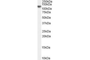ABIN190823 (0. (CYLD 抗体  (Internal Region))