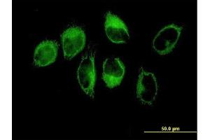 Immunofluorescence of purified MaxPab antibody to THBS1 on HeLa cell. (Thrombospondin 1 抗体  (AA 1-1170))