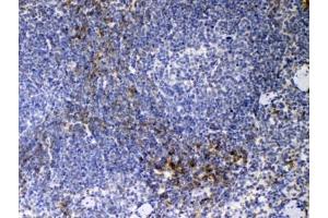 Immunohistochemistry (IHC) image for anti-CD14 (CD14) (AA 16-260) antibody (ABIN5708067)