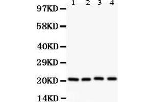 Western Blotting (WB) image for anti-Caveolin 1, Caveolae Protein, 22kDa (CAV1) (AA 4-178) antibody (ABIN3043803) (Caveolin-1 抗体  (AA 4-178))