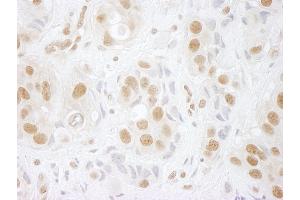Immunohistochemistry (IHC) image for anti-hPrp3p (AA 100-150) antibody (ABIN7448600) (hPrp3p (AA 100-150) 抗体)