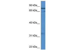 WB Suggested Anti-GFM2 Antibody Titration: 0. (GFM2 抗体  (C-Term))