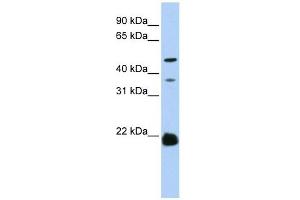 ZDHHC14 antibody used at 1 ug/ml to detect target protein. (ZDHHC14 抗体  (N-Term))