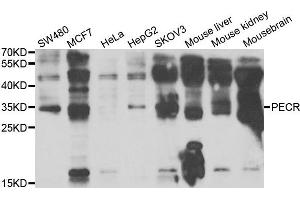 Western blot analysis of extracts of various cell lines, using PECR antibody. (PECR 抗体)