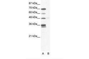Image no. 1 for anti-GLIS Family Zinc Finger 2 (GLIS2) (AA 83-132) antibody (ABIN202714) (GLIS2 抗体  (AA 83-132))