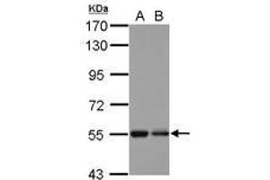 Image no. 1 for anti-Kelch Repeat and BTB (POZ) Domain Containing 4 (KBTBD4) (AA 287-518) antibody (ABIN1501896) (KBTBD4 抗体  (AA 287-518))