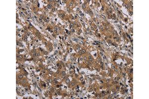 Immunohistochemistry (IHC) image for anti-Myelin and Lymphocyte Protein, T Cell Differentiation Protein (MAL) antibody (ABIN2433347) (MAL 抗体)