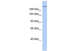 WB Suggested Anti-CACNA1G Antibody Titration:  0. (CACNA1G 抗体  (C-Term))