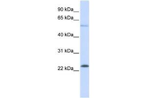 Western Blotting (WB) image for anti-GTPase Kras (KRAS) antibody (ABIN2459898) (K-RAS 抗体)