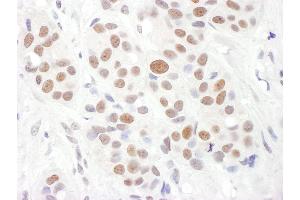 Immunohistochemistry (IHC) image for anti-Telomeric Repeat Binding Factor 2, Interacting Protein (TERF2IP) (AA 100-150) antibody (ABIN7454924)