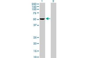 Western Blot analysis of PSMD5 expression in transfected 293T cell line by PSMD5 MaxPab polyclonal antibody. (PSMD5 抗体  (AA 1-504))