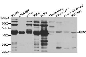 Western blot analysis of extracts of various cell lines, using CHN1 antibody. (CHN1 抗体  (AA 1-200))
