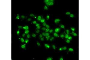 Immunofluorescence analysis of A-549 cells using WBSCR22 antibody (ABIN6132946, ABIN6150175, ABIN6150176 and ABIN6223157). (WBSCR22 抗体  (AA 1-281))