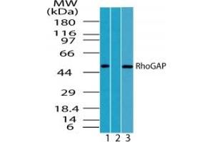 Image no. 1 for anti-rho GTPase Activating Protein 1 (ARHGAP1) (AA 1-50) antibody (ABIN207682) (ARHGAP1 抗体  (AA 1-50))