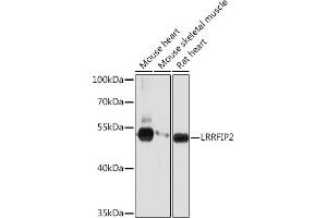 Western blot analysis of extracts of various cell lines, using LRRFIP2 Rabbit pAb (ABIN7268214) at 1:1000 dilution. (LRRFIP2 抗体  (AA 150-340))