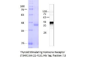Image no. 2 for Thyroid Stimulating Hormone Receptor (TSHR) (AA 22-413) protein (His tag) (ABIN3134134)