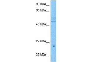 Host:  Rabbit  Target Name:  UBP48  Sample Tissue:  Human Lymph Node Tumor lysates  Antibody Dilution:  1ug/ml (USP48 抗体  (N-Term))