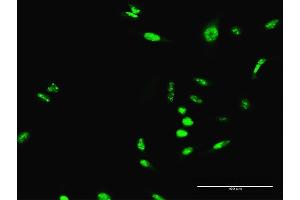 Immunofluorescence of purified MaxPab antibody to SCML1 on HeLa cell.