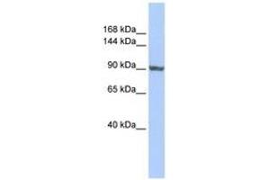 Image no. 1 for anti-TNNI3 Interacting Kinase (TNNI3K) (AA 755-804) antibody (ABIN6741016) (TNNI3K 抗体  (AA 755-804))