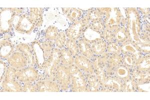 Immunohistochemistry (IHC) image for anti-Granulin (GRN) (AA 361-585) antibody (ABIN7440077)