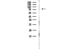 anti-Transmembrane Protein 48 (TMEM48) antibody