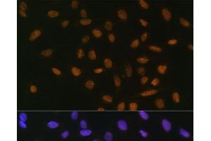 Immunofluorescence analysis of U-2 OS cells using Snail Polyclonal Antibody at dilution of 1:100. (SNAIL 抗体)