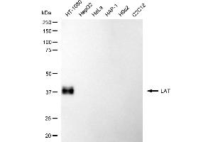 Western blotting analysis using LAT antibody (ABIN7799272). (Recombinant LAT 抗体)